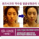시크릿체형관리 네이버블로그