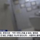 눈매교정 절대 하지마 눈수술 함부로 X 이미지