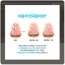 코시원이비인후과의원 네이버블로그