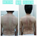 3H지압침대 대전 월평센터 | 대전 3H지압침대 전국1등 척추지압센터