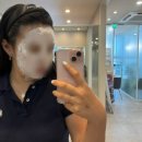 멍스터 | 포텐자 콜라겐 부스터 모공관리 콜라스터1회차 (솔직후기, 통증, 엠보, 멍, 붓기)