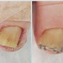 포시뷰티바 이미지