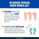 레푸스마곡
