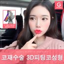 글로비성형 네이버블로그