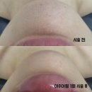 영주스킨케어 이미지