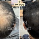 깐느헤어 이미지