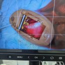 참좋은보청기 | 서문동보청기 " 뉴히어링 보청기 청주센터 "에 방문후기