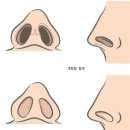 일퍼센트성형외과의원 이미지