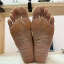 루앤나샵 | 목포발각질 닥터아이티엔 루&나샵에서 해결했어요