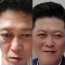 인셀덤 송도