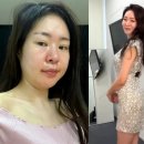 미자네 이미지