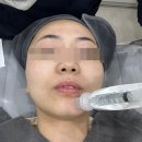 데이샤인의원 | 닥터고운선의원 릴리이드M 물광주사 효과 (+손주사/더마샤인 비교후기)