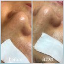 김원장면역테라피 | 피부트러블 여드름이 고민이세요? 피부면역케어 이지미에스테틱 미생물관리로 해결하세요.