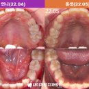 내이처럼치과병원 이미지