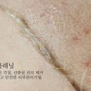 미엘피부관리 이미지