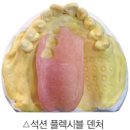 프레임치과기공소 이미지