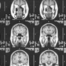 서울특별시 성동구 치매안심센터 이미지