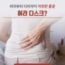 엉덩이~다리까지 저린가요? ‘좌골신경통’ 주요 증상 &amp; 원인 이미지