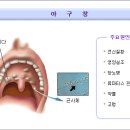 아구창 이미지