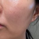 피부 재생에 좋은 에스테틱 브랜드 라숌브 라팡 리뉴크림 후기