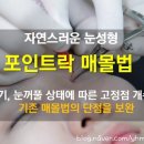 뷰티젠의원 이미지