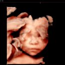 모태안여성병원 | 모태안여성병원 24주 임당 검사 후기, 입체초음파