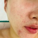 예쁜여우피부관리 이미지