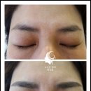 수가인 이미지