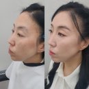 오블리속눈썹 이미지