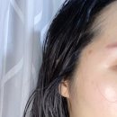 트러블을 잠재워 줄 트러블케어크림 소리온크림