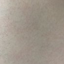 윤인헤어 | 일리윤 세라마이드 아토 집중크림 후기/ 6일간의 피부변화 /건성피부,민감성피부 추천 !