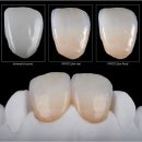 덴탈시스템 이미지