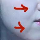 [내돈내산] 내가 안까먹으려고 쓰는 울쎄라 200샷 후기