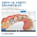자연드림치과기공소 이미지