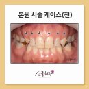 트윈치과기공소 이미지