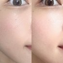 (주)에스에이치에너지 | 슈알리아 SHC-100 뉴트리션 앰플 1주차후기