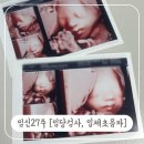 초앤유여성병원 | 임신27주증상 초앤유여성병원 임당검사 주의사항, 입체초음파 후기