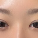 비니래쉬앤뷰티 이미지