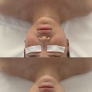 코아메디칼 | 고급스러운 부산신부관리에 진심인 코아 웨딩관리 후기, 서면[코아페이즈]