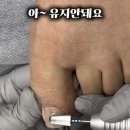 골드문네일 이미지