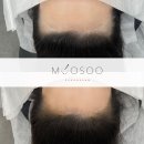 이미지헤어라인 이미지