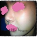 이*식 네이버블로그