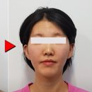 인중 이미지
