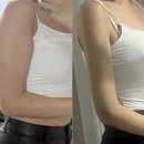 인천다이어트병원 팔무한람스 3개월 최종후기