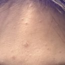 블리비의원 이미지