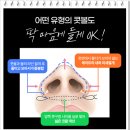 꿈꾸는성형외과의원 | 콧대 높이기 수술 비용 및 콧대 시술 방법, 회복기간, 후기 살펴보기