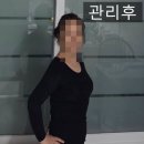 동부-7 | 이촌동헬스장 동부이촌동쥬비스에서 7kg 뺐어요