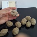 GS25 개금백병원점 | 부산 개금 백병원 (담낭절제술) 입원 _ 복통 응급실, 기도응답