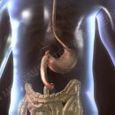 전이 암[Metastatic cancer]종양혈액질환 이미지