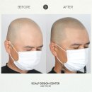 스칼프디자인센터 이미지